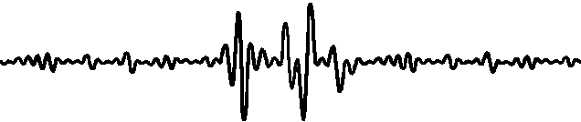 磁疗对高血压作用2.gif undefined