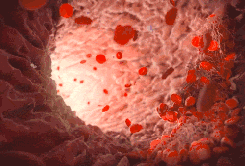 磁疗对高血压作用4.gif undefined