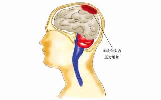 磁疗4.jpg
